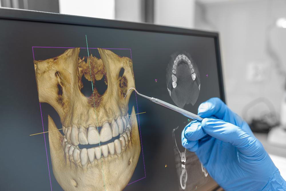 close up of digital x ray | dentist oakbrook terrace