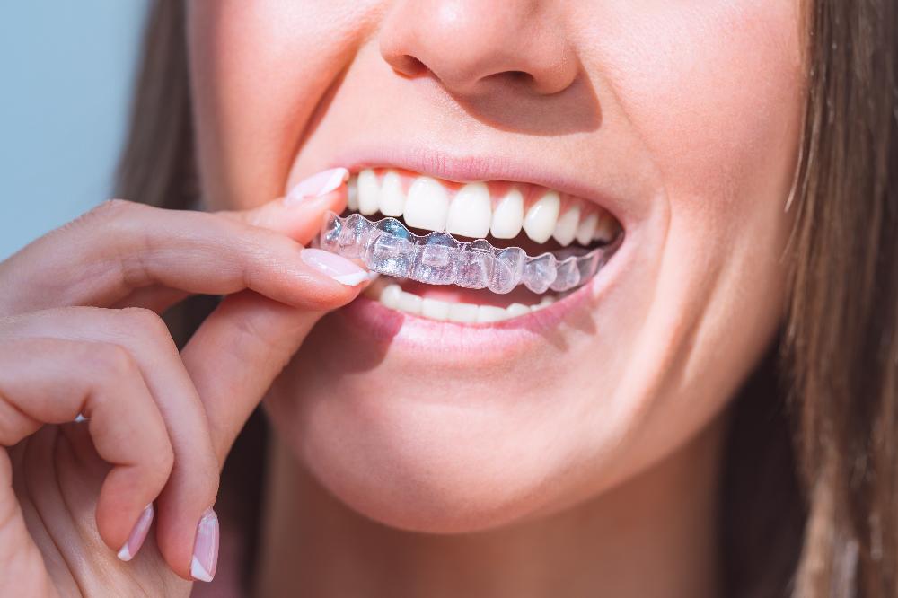 person holding invisalign clear aligner | invisalign oakbrook terrace